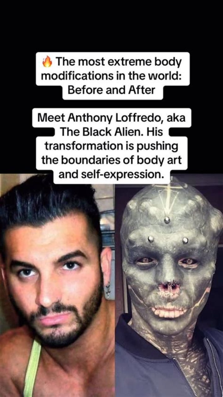 Anthony Loffredo: The Inspiring Journey of a Body Modification Enthusiast