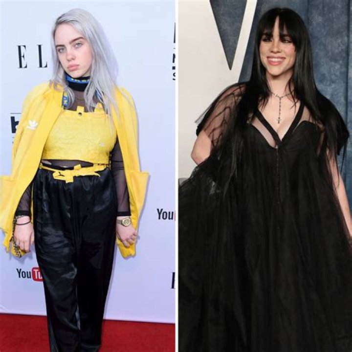 Did Billie Eilish Have a Breast Reduction? Everything You Need to Know