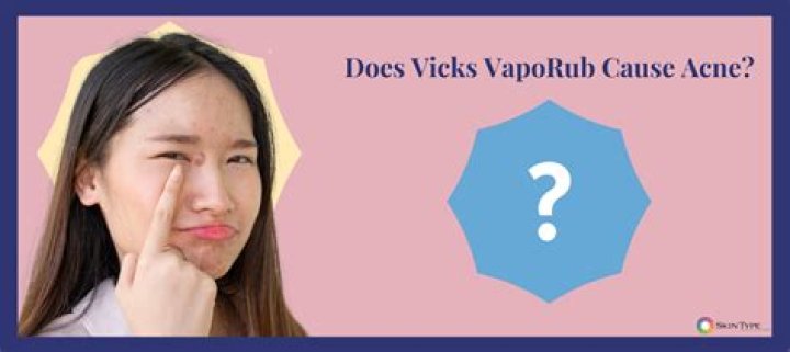 Does Vicks Help with Acne? Unveiling the Truth Behind the Trend