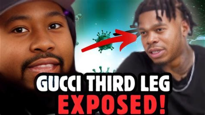 Gucci 3rd Leg Sores: Causes, Symptoms, and Treatment Options