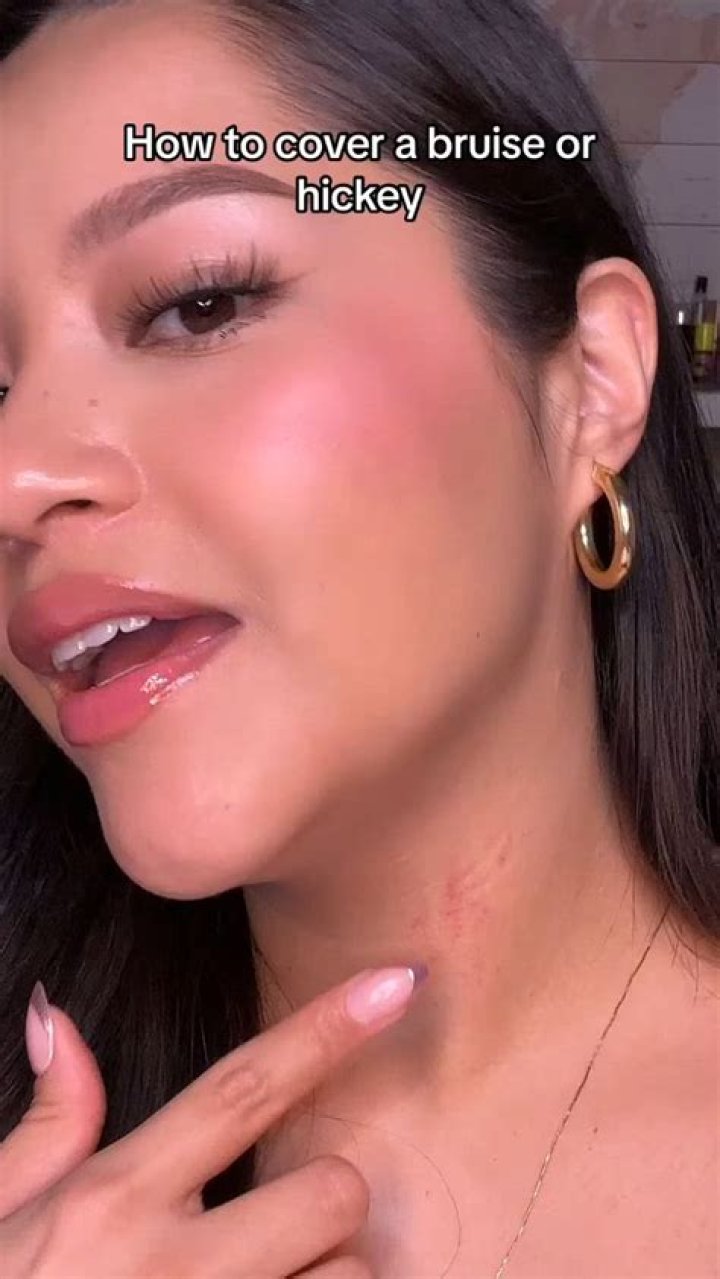 How to Hide Hickey Marks: Expert Tips and Tricks for Quick Cover-Up
