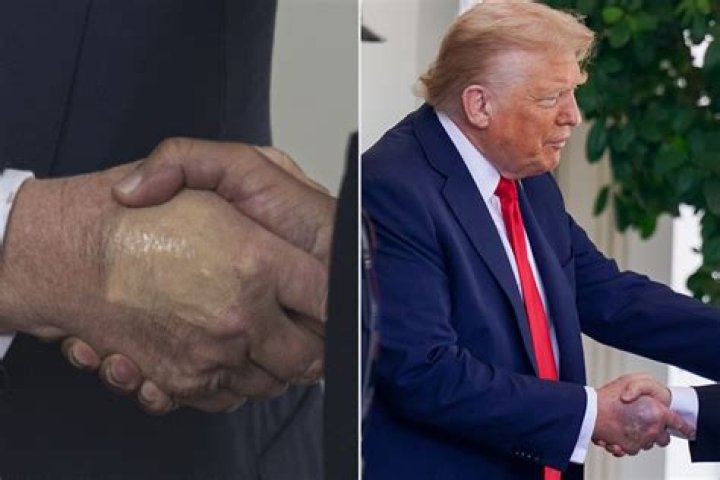Is Donald Trump Left-Handed? Unraveling the Truth Behind the President's Dominant Hand