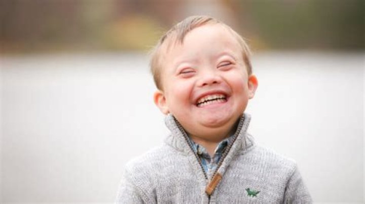 Jason Kelce's Kids and Down Syndrome: A Journey of Love, Support, and Awareness