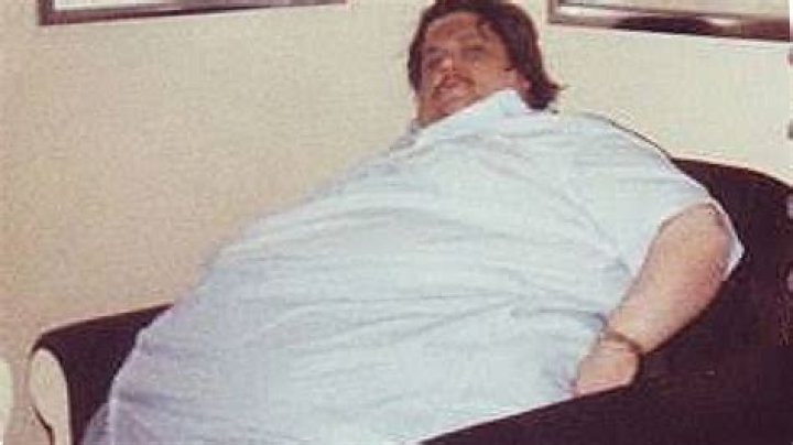 Understanding Jon Minnoch: The Story of the Heaviest Man in Medical History